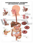 Gastroesophageal Disorders and Digestive Anatomy Anatomical Chart, 2nd Edition